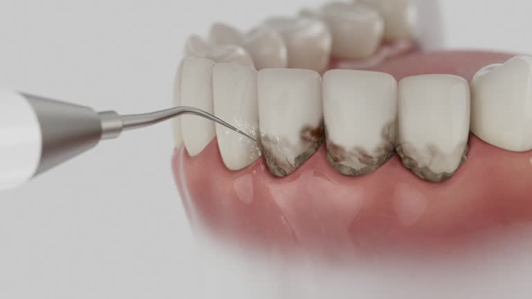 Reliable Dental contractor in Port Clinton, OH by Dentist Open Now